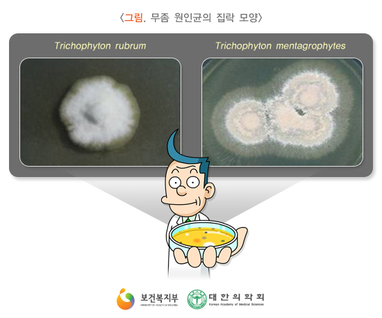 이미지명