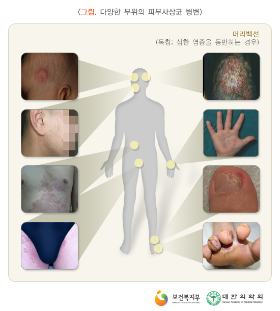 이미지명