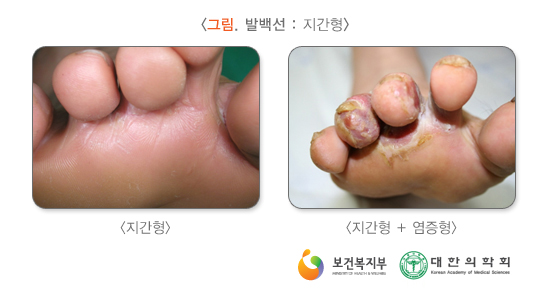 이미지명