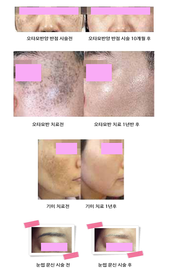 이미지명