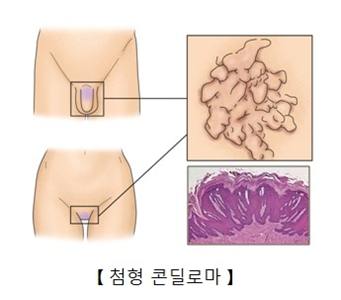 이미지명