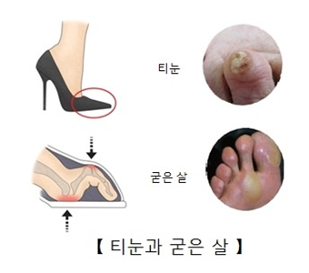 이미지명